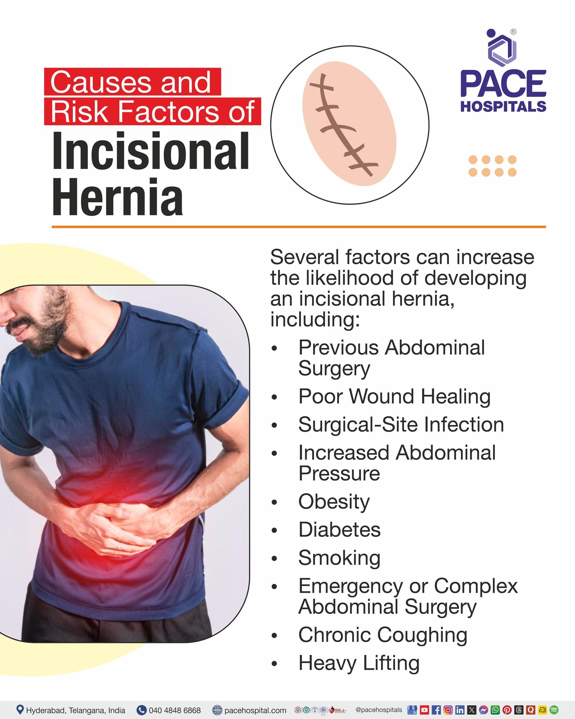 Causes & Risk Factors of Incisional Hernia Incisional hernia causes & risk factors I
causes of incisional hernia surgical tips I incisional hernia risk factors