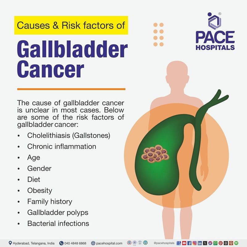 Gallbladder causes & Risk factors Gallbladder cancer causes | Gallbladder cancer risk factors | Image showing the causes & Risk factors of gallbladder cancer