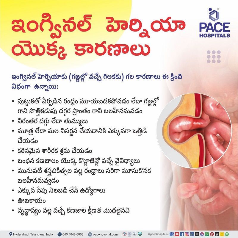 Inguinal hernia Causes In Telugu Causes of Inguinal hernia in Telugu | Inguinal Hernia Causes in Telugu | What are the causes of Inguinal hernia in Telugu