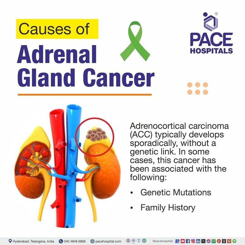 Adrenal cancer causes Adrenocortical carcinoma causes | illustration showing the cancer affected kidneys and the causes of adrenal gland cancer