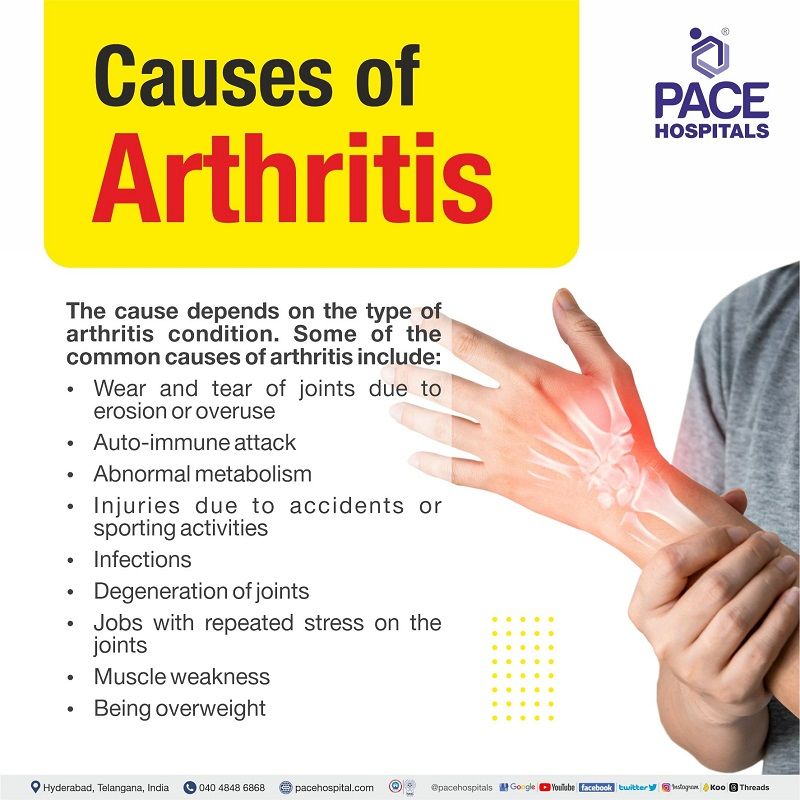arthritis disease causes what causes arthritis disease | what causes arthritis in young adults | arthritis causes and symptoms | how is arthritis caused | what is the main cause of arthritis disease