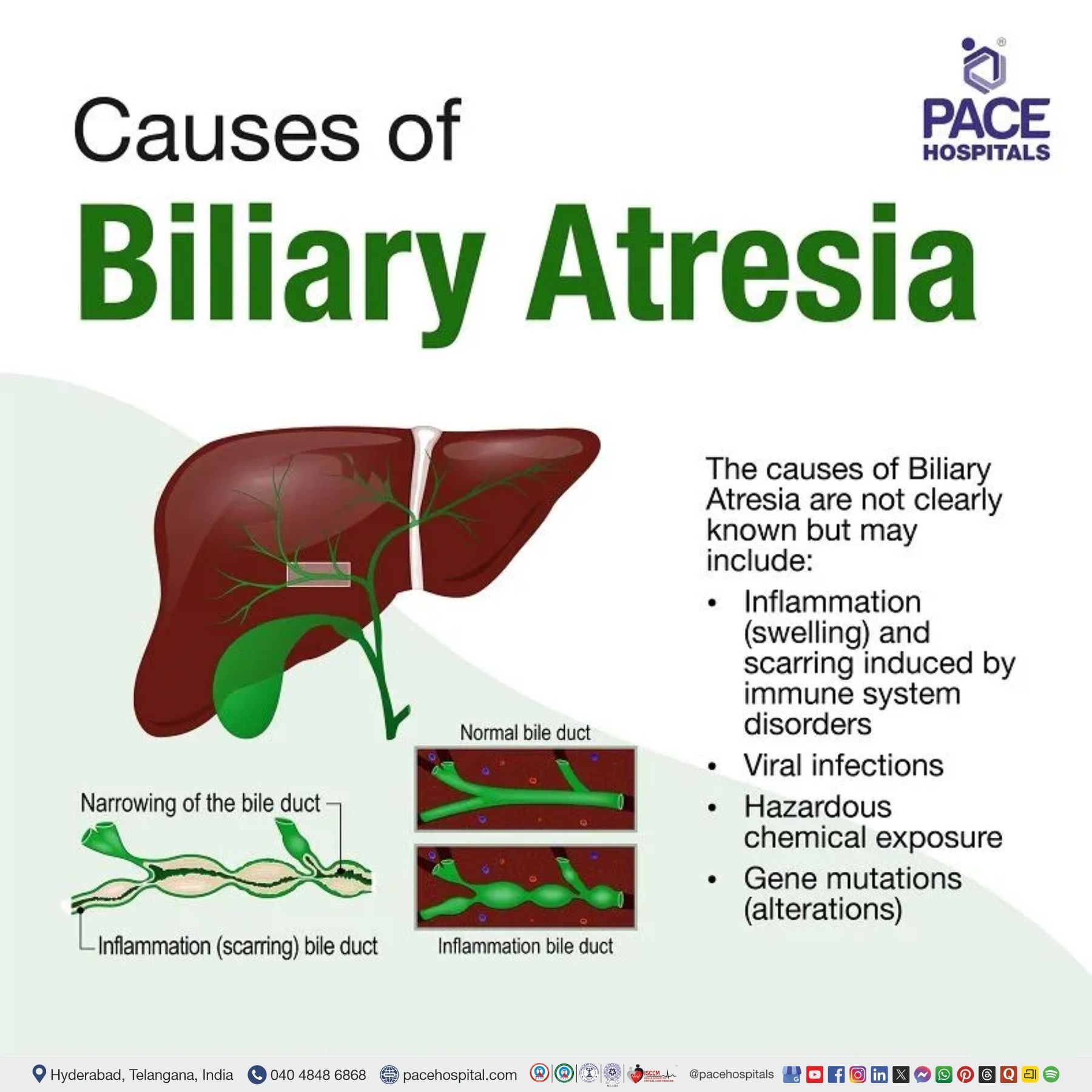 biliary atresia causes