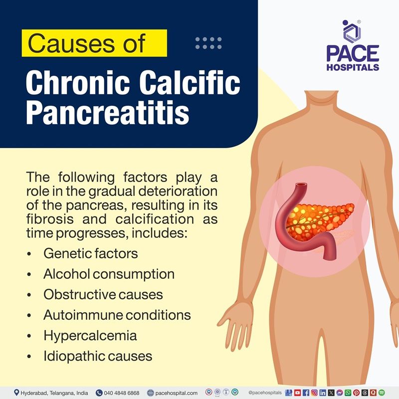 Chronic calcific pancreatitis causes Chronic calcific pancreatitis causes | Visual depicting the causes of chronic calcific pancreatitis