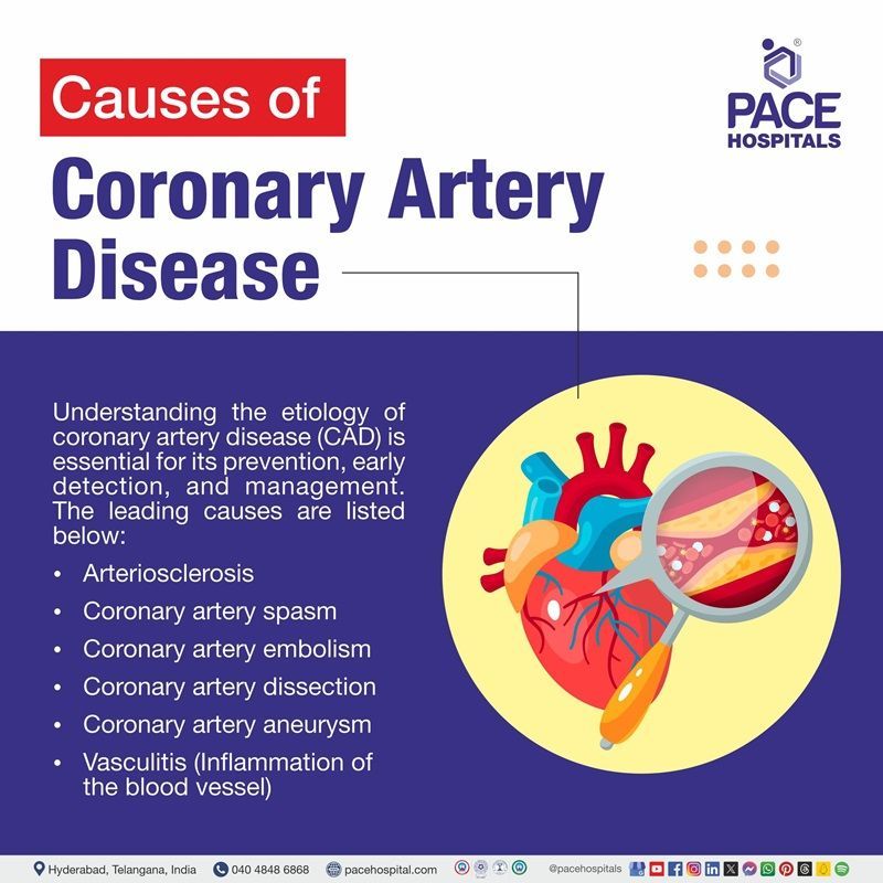 Causes of coronary artery disease coronary artery disease causes | what causes coronary artery disease | causes of coronary artery disease | what is the cause of coronary artery disease
