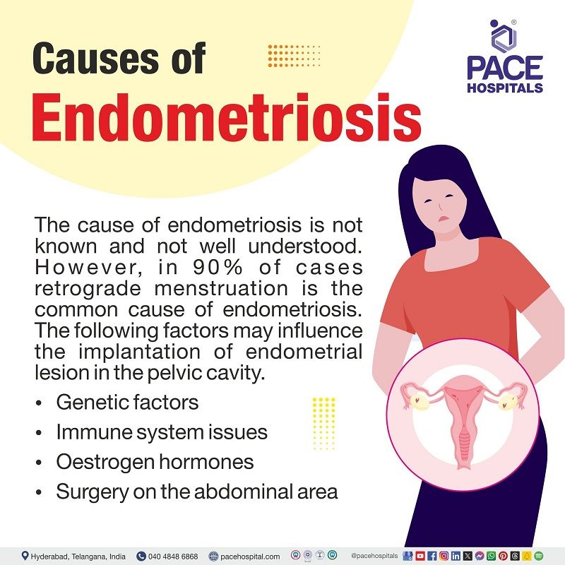 Lets check the causes of Endometriosis What causes endometriosis symptoms | Endometriosis causes | causes of endometriosis | factors contributing to endometriosis | woman clutching her abdomen indicating pain in the uterus and the text depicting the causes of Endometriosis