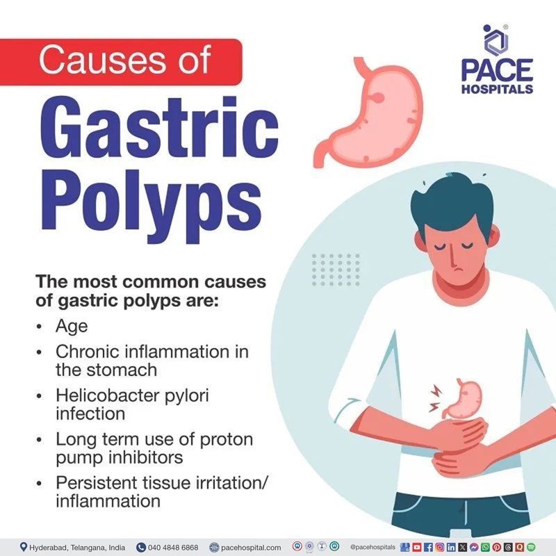 Gastric polyps causes​ | infographic showing gastric polyps causes