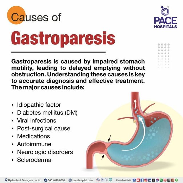Gastroparesis: Symptoms, Causes, Diagnosis, Treatment, Prevention