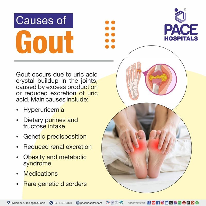 Gout Causes Gout Causes | 9 causes of Gout | Gout Causes | Causes of Gout