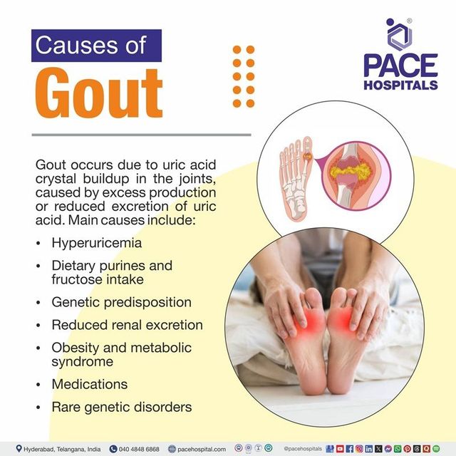 Gout: Symptoms, Causes, Diagnosis, Treatment & Prevention