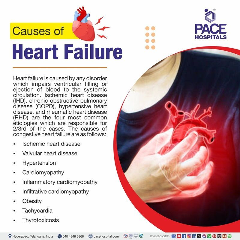 Causes of heart failure causes of heart failure | Visual depicting the congestive heart failure causes