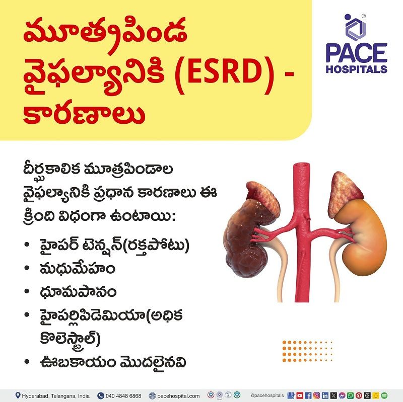 Causes of kidney failure in Telugu Causes of kidney failure in Telugu | తెలుగులో మూత్రపిండాల వైఫల్యానికి కారణాలు | Kidney failure causes in Telugu | తెలుగులో కిడ్నీ ఫెయిల్యూర్ కారణమవుతుంది | మూత్రపిండాల వైఫల్యం కారణమవుతుంది | kidney failure causes | kidney failure (ESRD)