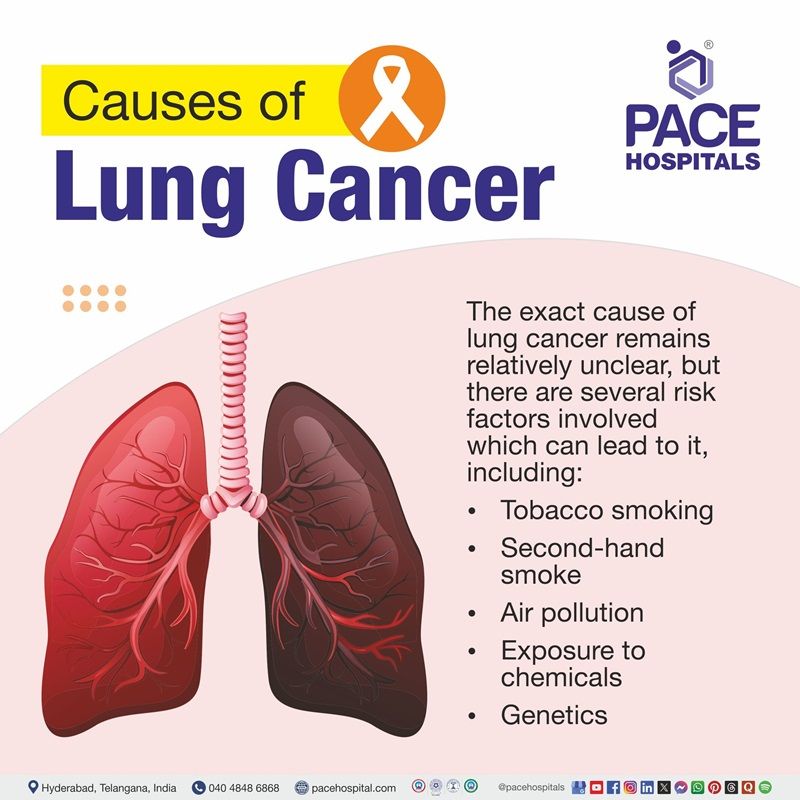 Causes of lung cancer lungs cancer causes | Visual depicting the various causes of lung cancer