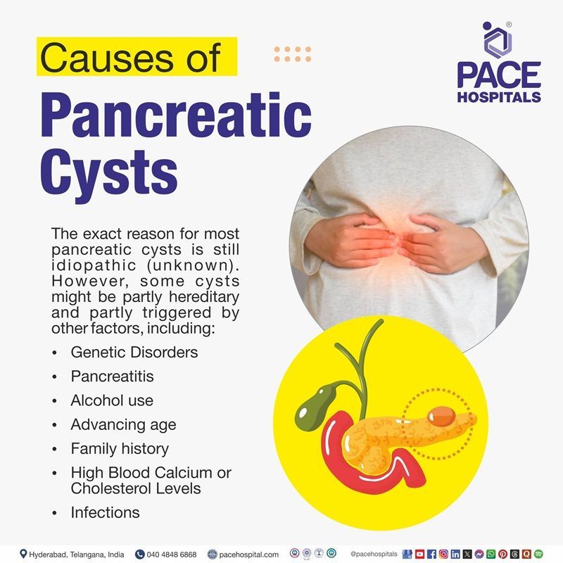 Pancreatic Cyst Causes Pancreatic Cyst Causes | visual depicting the causes of Pancreatic Cyst