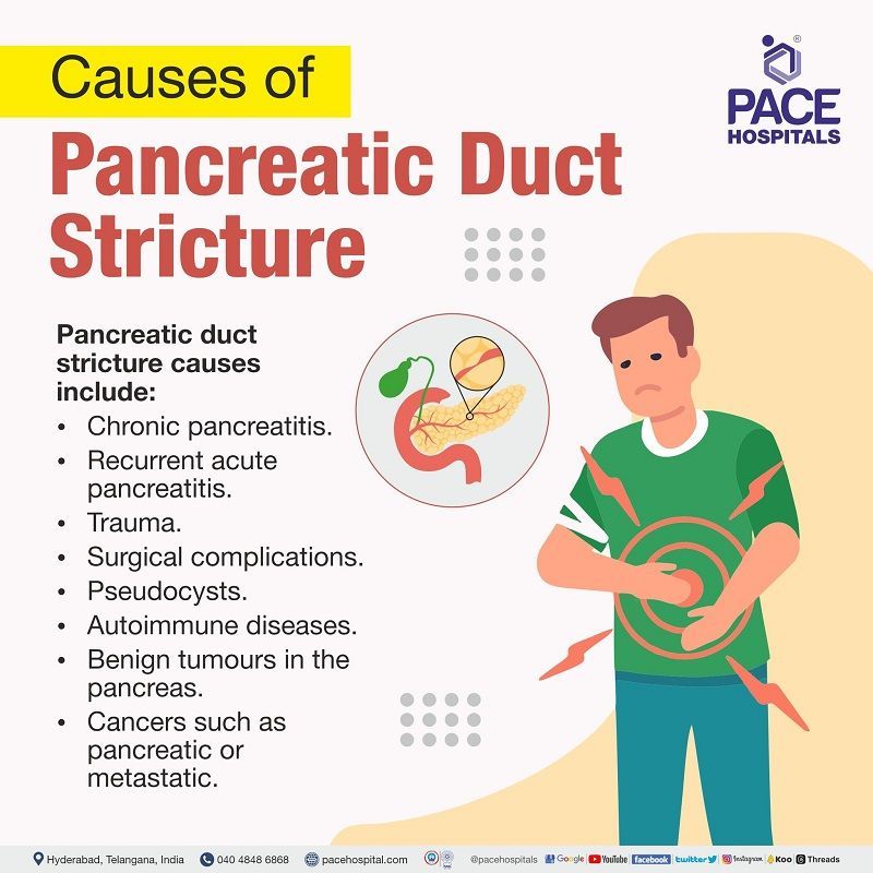 Pancreatic Duct Stricture Causes Causes of Pancreatic Duct Strictures | Benign and Malignant Pancreatic Ductal Strictures Causes | Treatment of Pancreatic Duct Stricture