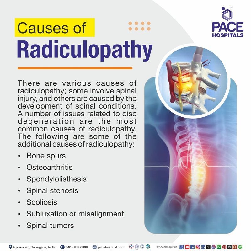 Radiculopathy Causes | cervical radiculopathy causes​
