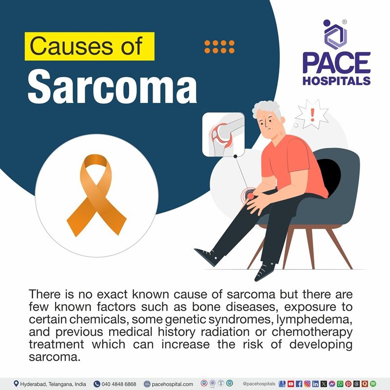 Sarcoma causes Sarcoma causes | Visual depicting the different sarcoma causes
