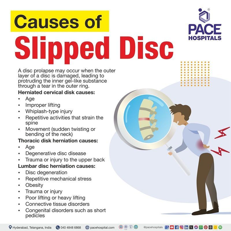 Slipped disc (Herniated disk) causes slip disc causes | what causes a slipped disc | herniated disc causes | what causes a herniated disc | lumbar disc herniation cause | Visual depicting the causes of Slipped disc and a person affected with disc herniation