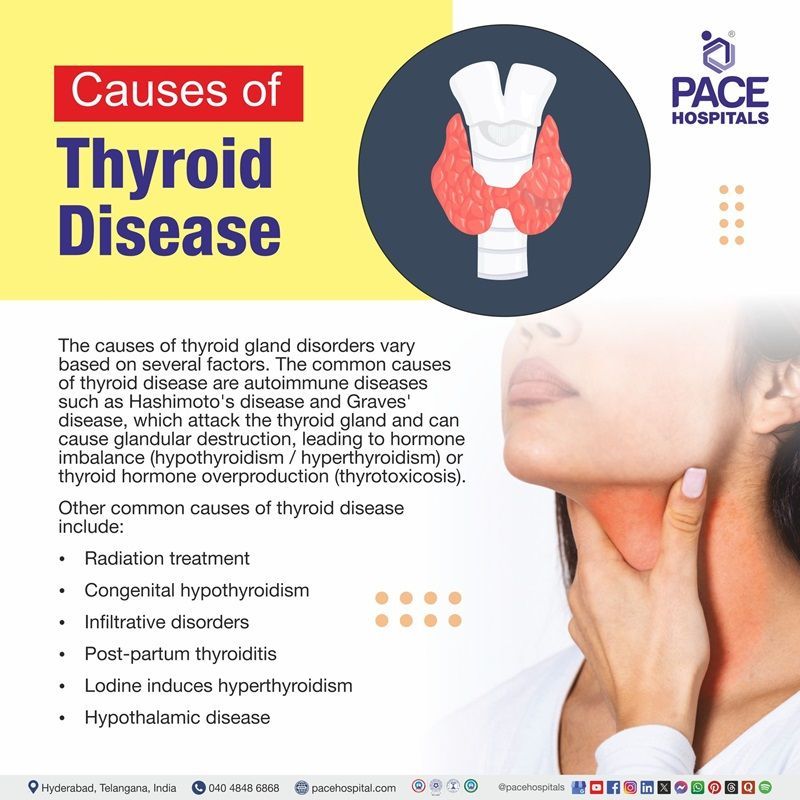 What causes thyroid disease | image showing the list of causes of Thyroid disease