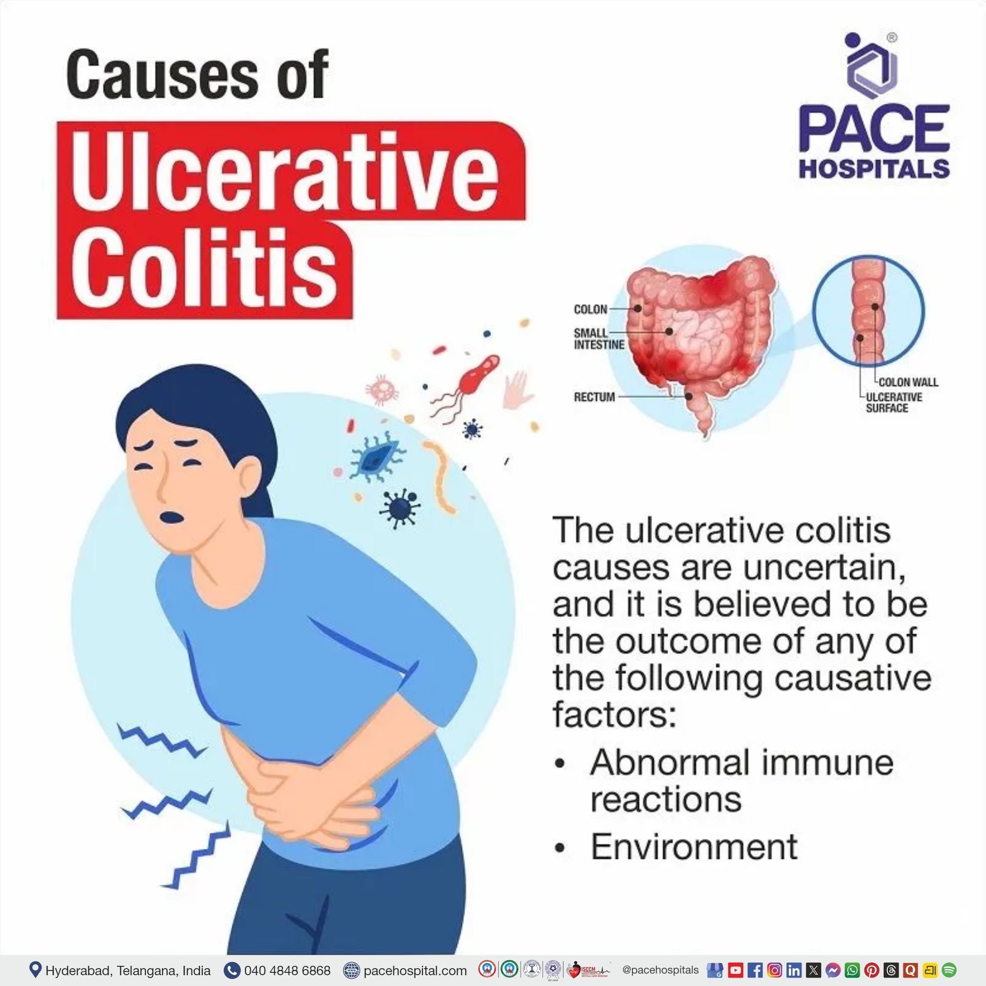 ulcerative colitis causes | ulcerative colitis causes and symptoms | chronic ulcerative colitis causes | causes of ulcerative colitis disease