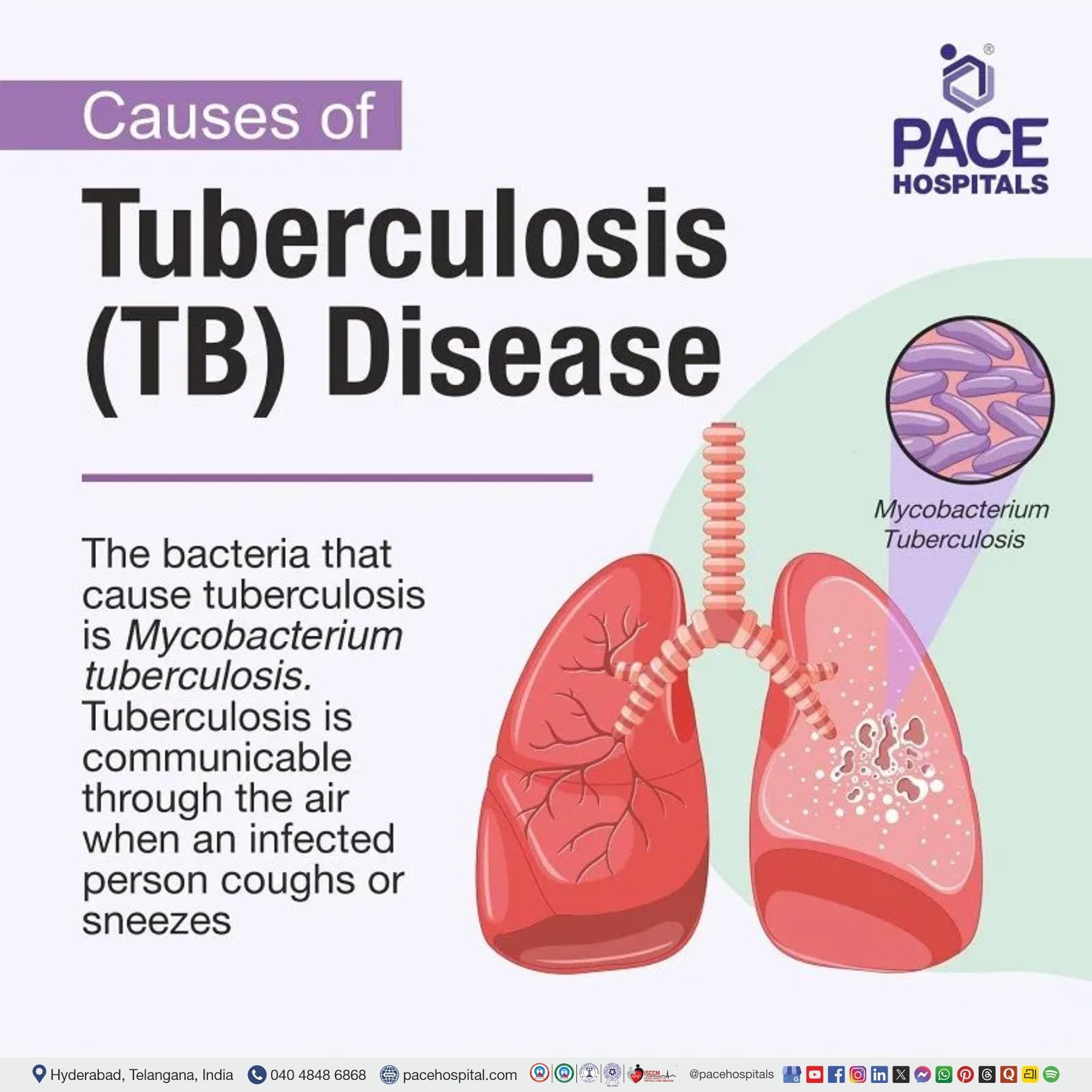 tuberculosis causes | bacteria that causes tuberculosis mycobacterium tuberculosis | causes of pulmonary tuberculosis | how is tuberculosis caused