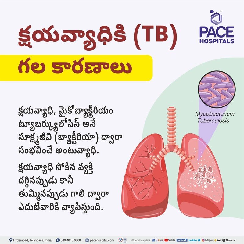 Tuberculosis (TB) causes telugu causes of tb in telugu language | causes of Tuberculosis in telugu language | Tuberculosis causes in telugu | TB causes in telugu