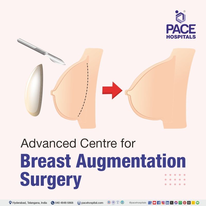 Advanced Centre for Breast Augmentation Surgery in Hyderabad, India Best Hospital for Breast Augmentation Surgery in Hyderabad India | best breast augmentation surgery hospital in Hyderabad | breast augmentation surgery near me