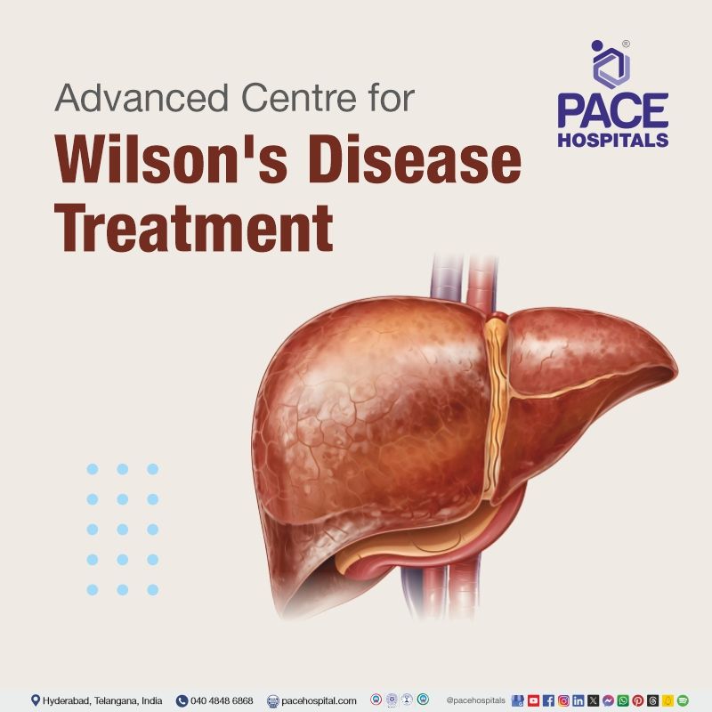 Advanced Centre for Wilson Disease Treatment in Hyderabad, India Wilson disease treatment in Hyderabad, India | best hospital for Wilson's disease in India | Wilson's disease treatment cost | Wilson disease treatment near me