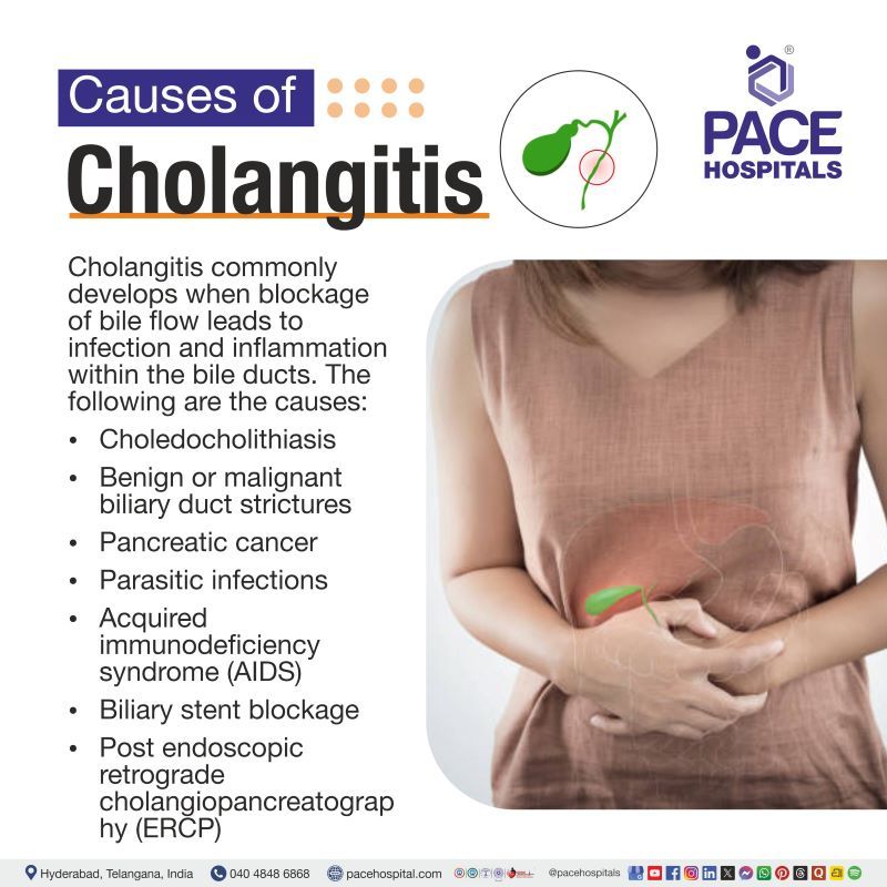 Causes of Cholangitis Cholangitis Causes | What causes cholangitis infection | Causes of acute cholangitis