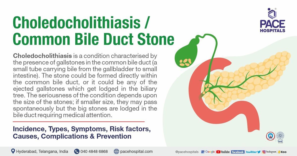 Choledocholithiasis, CBD Stone - Symptoms, Types, Causes, Complications, Treatment & Prevention