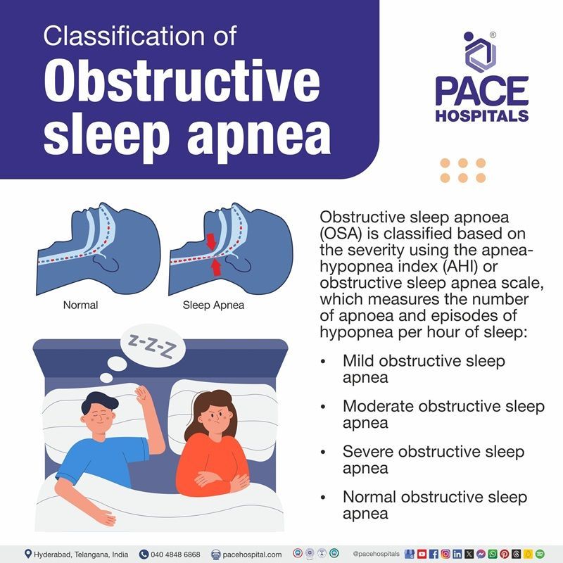 Obstructive sleep apnea classification obstructive sleep apnea classification | classification of obstructive sleep apnea | multimodal classification of obstructive sleep apnea | Visual showing the classification of obstructive sleep apnea