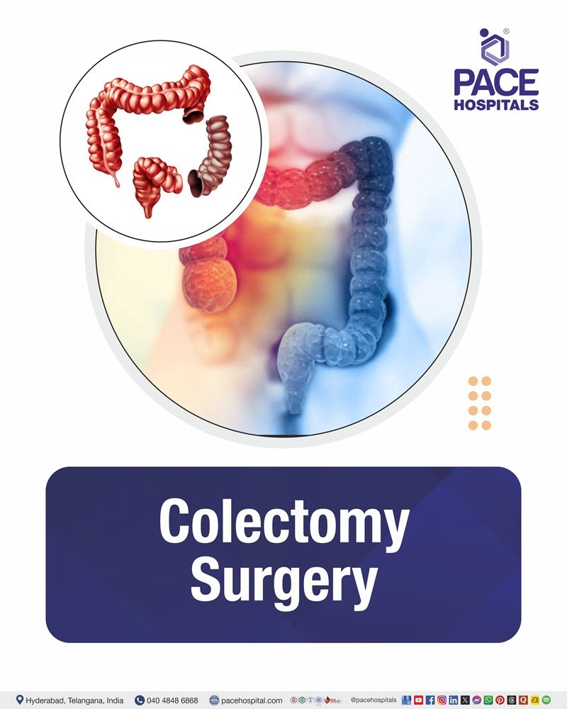 Colectomy Surgery Cost in Hyderabad | Affordable Colectomy Surgery in India