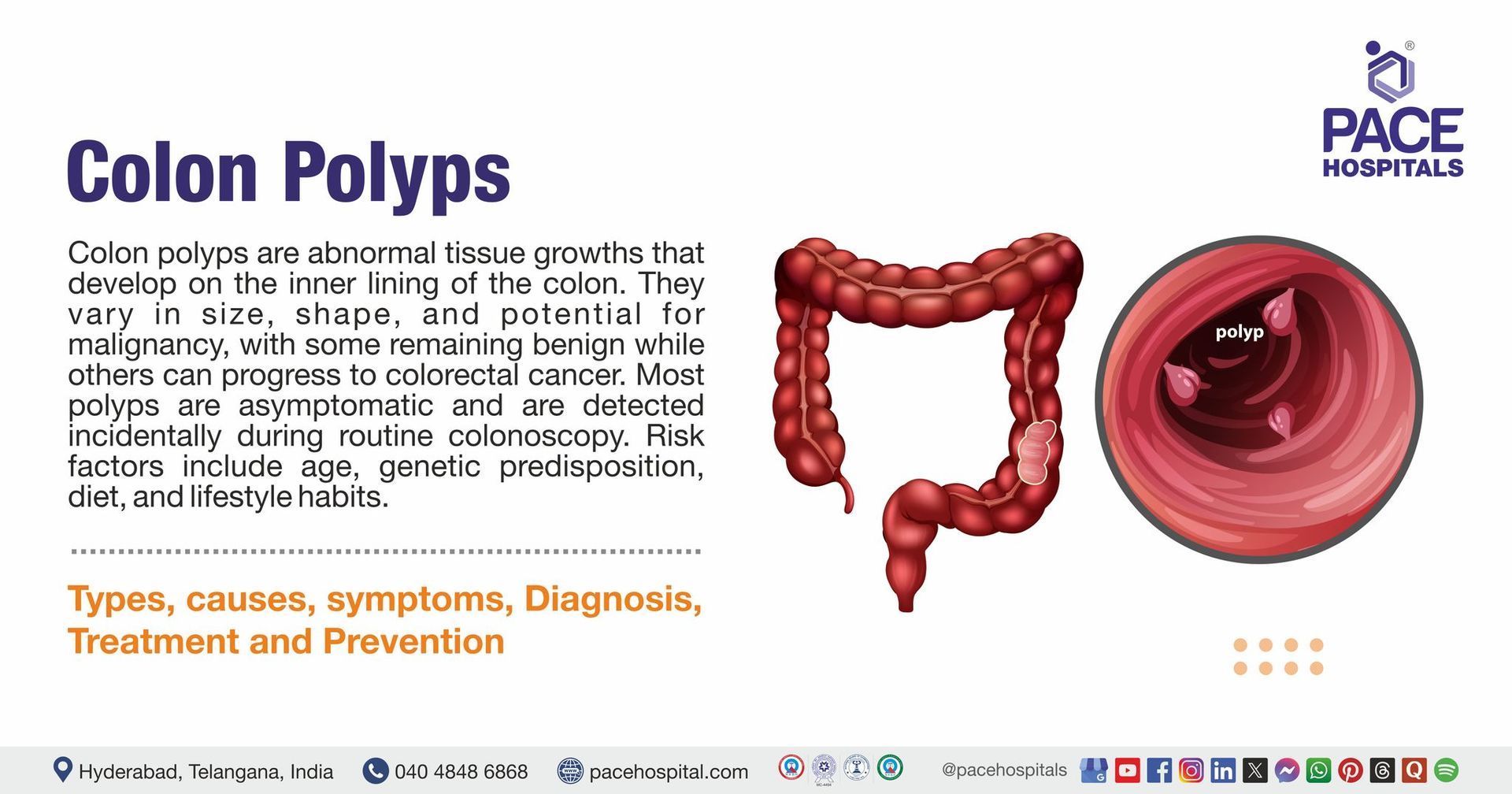 Colon Polyps Symptoms & Causes | Colon Polyps treatment in India