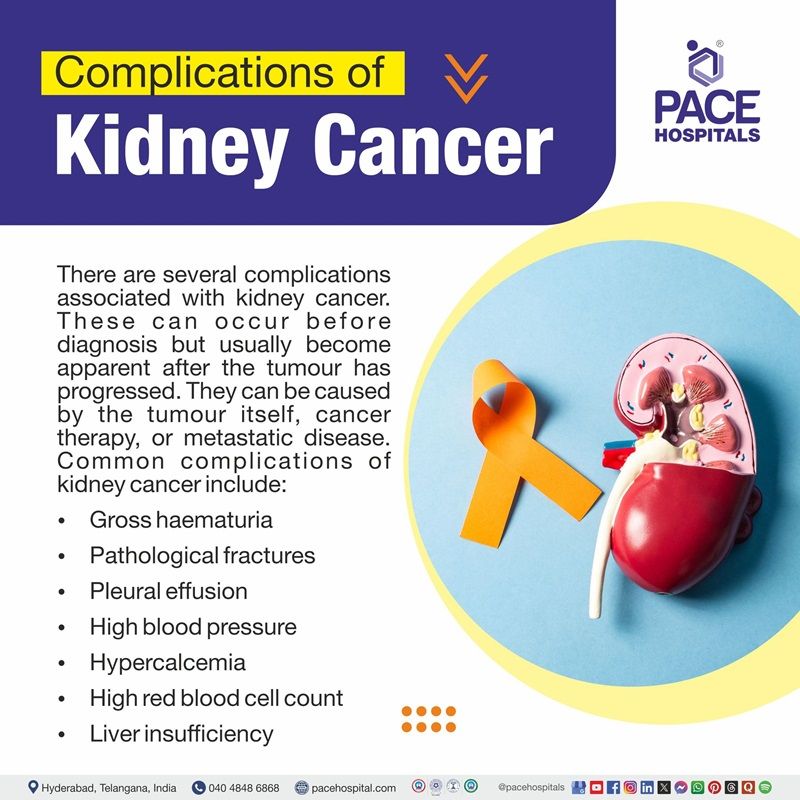 Kidney Cancer Complications Kidney cancer complications | Diagram illustrating the complications of Kidney cancer