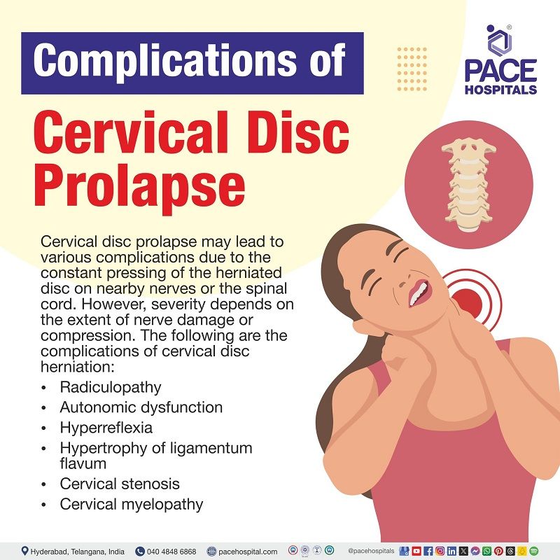 complications of Cervical disc prolapse Cervical disc prolapse complications | | Cervical disc herniation complications | complications of Cervical disc herniation| Disc prolapse complications | Visual revealing the complications of Cervical disc prolapse