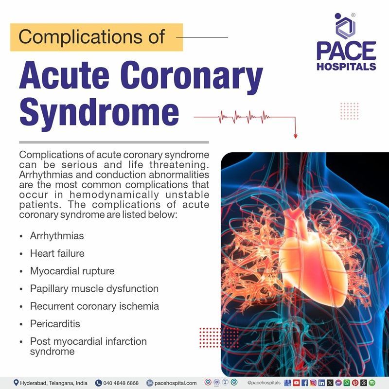 acute coronary syndrome complications​ | complications of acute coronary syndrome | What are the complications of acute coronary syndrome | Visual depicting the complications of acute coronary syndrome