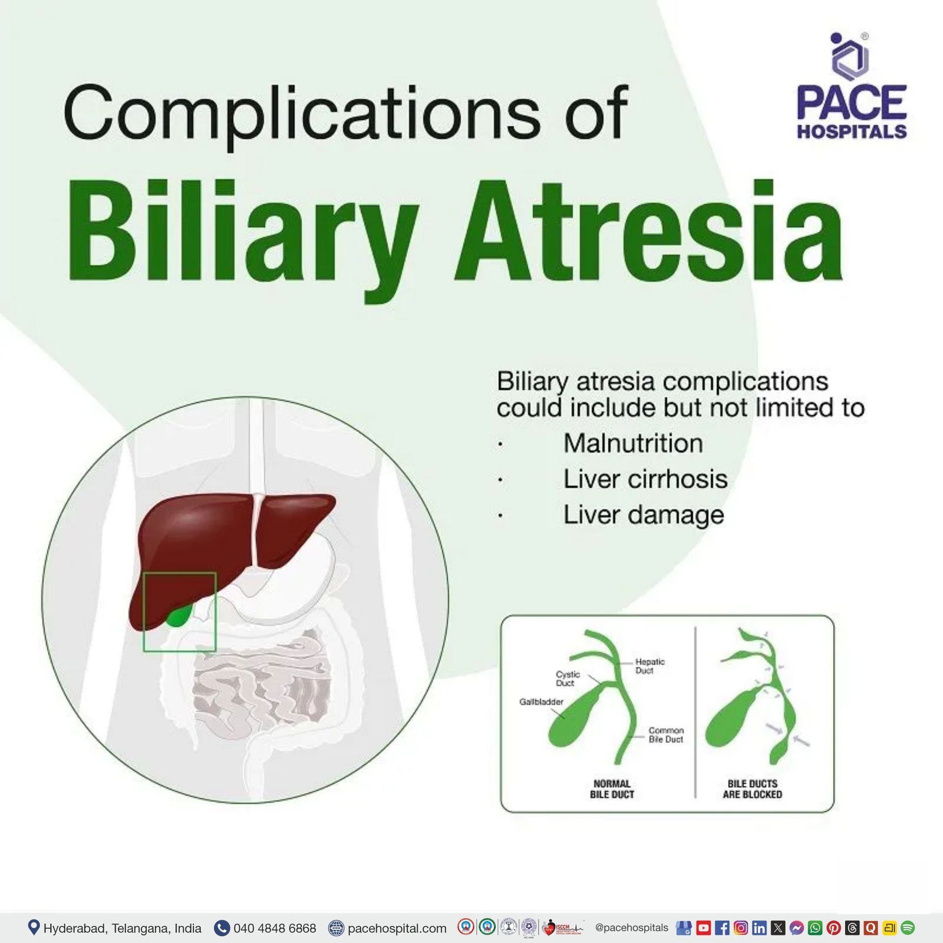 biliary atresia complications