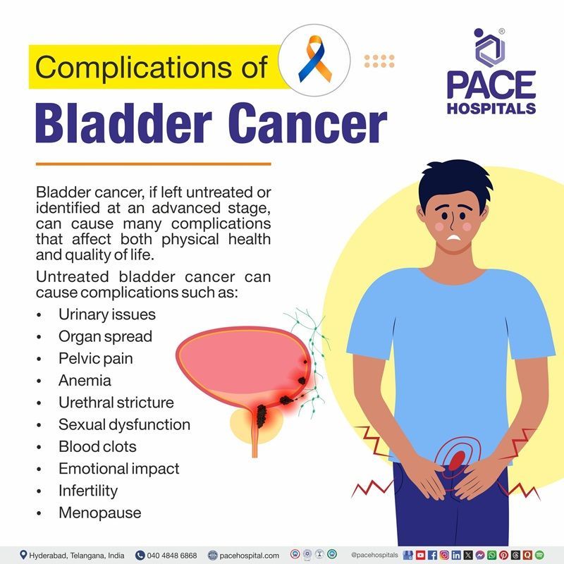 Complications of bladder cancer Complications of bladder cancer | image showing the complications of bladder cancer