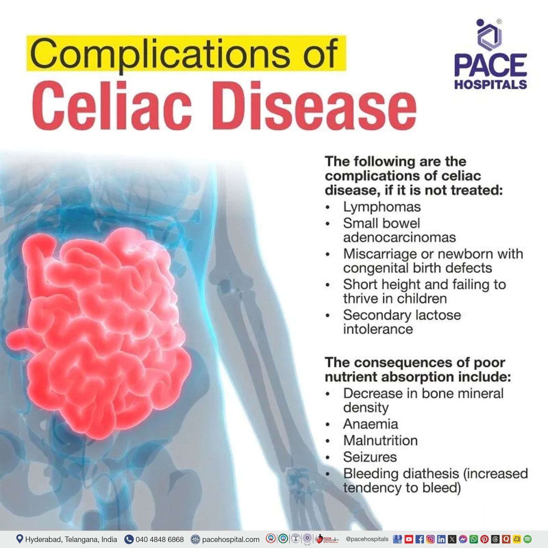Complications of Celiac Disease