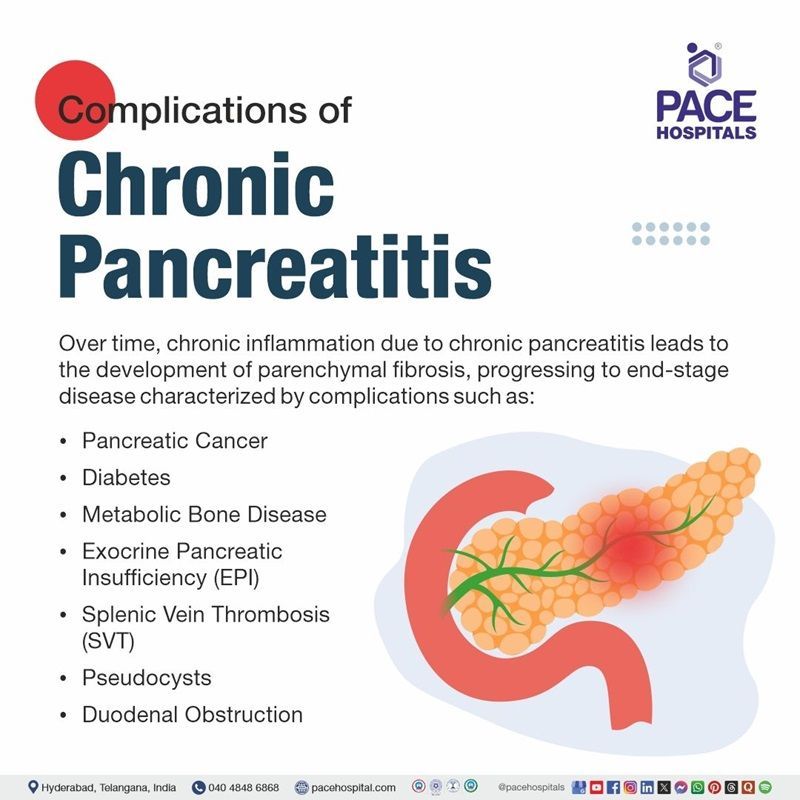 Complications of chronic pancreatitis​ | Image showing Chronic Pancreatitis complications
