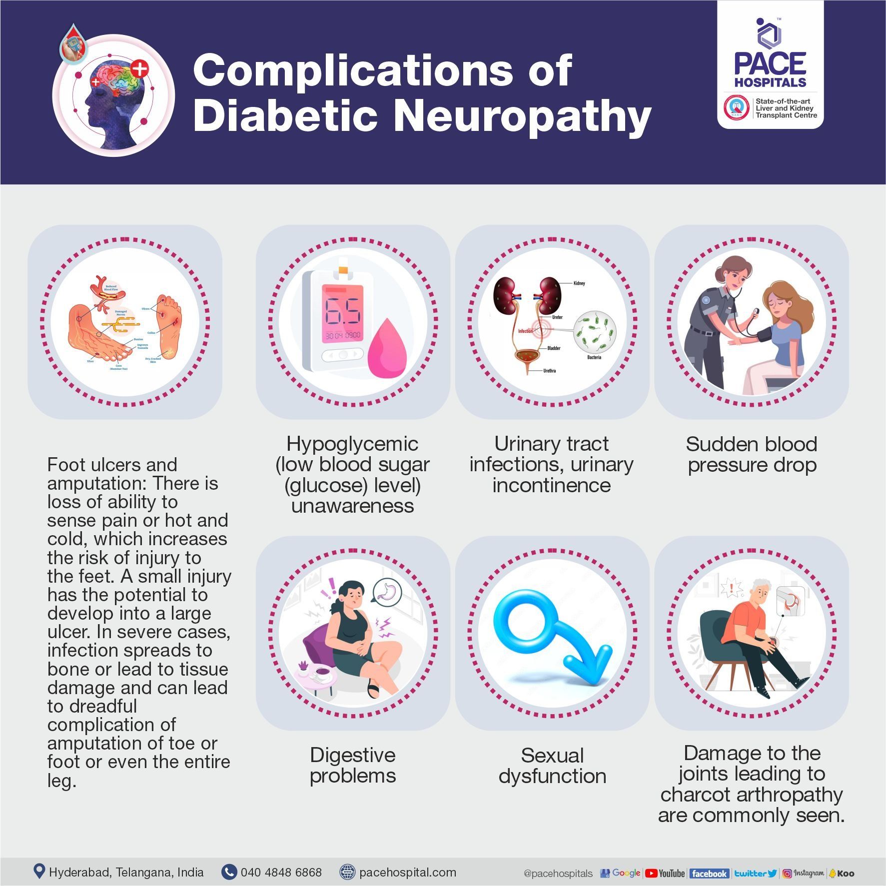 Complications of Diabetic Neuropathy Complications of Diabetic Neuropathy