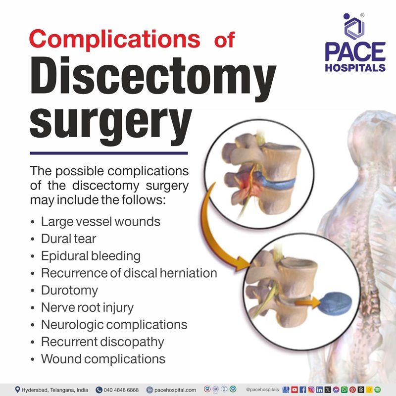Discectomy surgery or procedure complications complications of Discectomy surgery or procedure