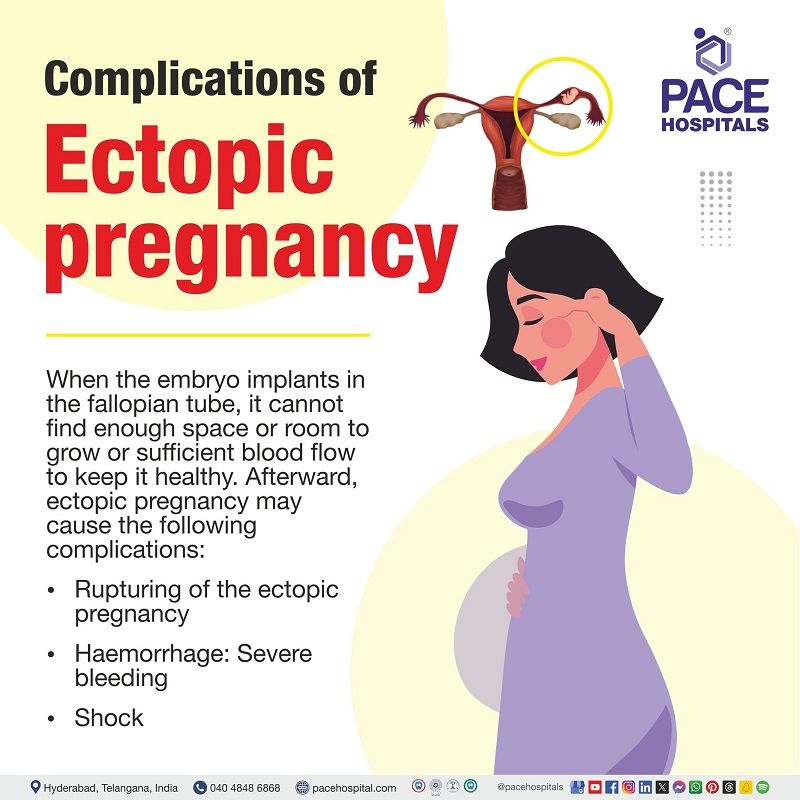Lets know the complications of Ectopic pregnancy. Ectopic pregnancy complications | complexities of Ectopic pregnancy | problems of ectopic pregnancy | woman with ectopic pregnancy complication | Ectopic pregnancy risks