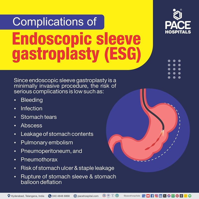 Complications of Endoscopic Sleeve Gastroplasty (ESG) endoscopic sleeve gastroplasty side effects | ESG endoscopic sleeve gastroplasty complications | ESG endoscopic sleeve gastroplasty cost