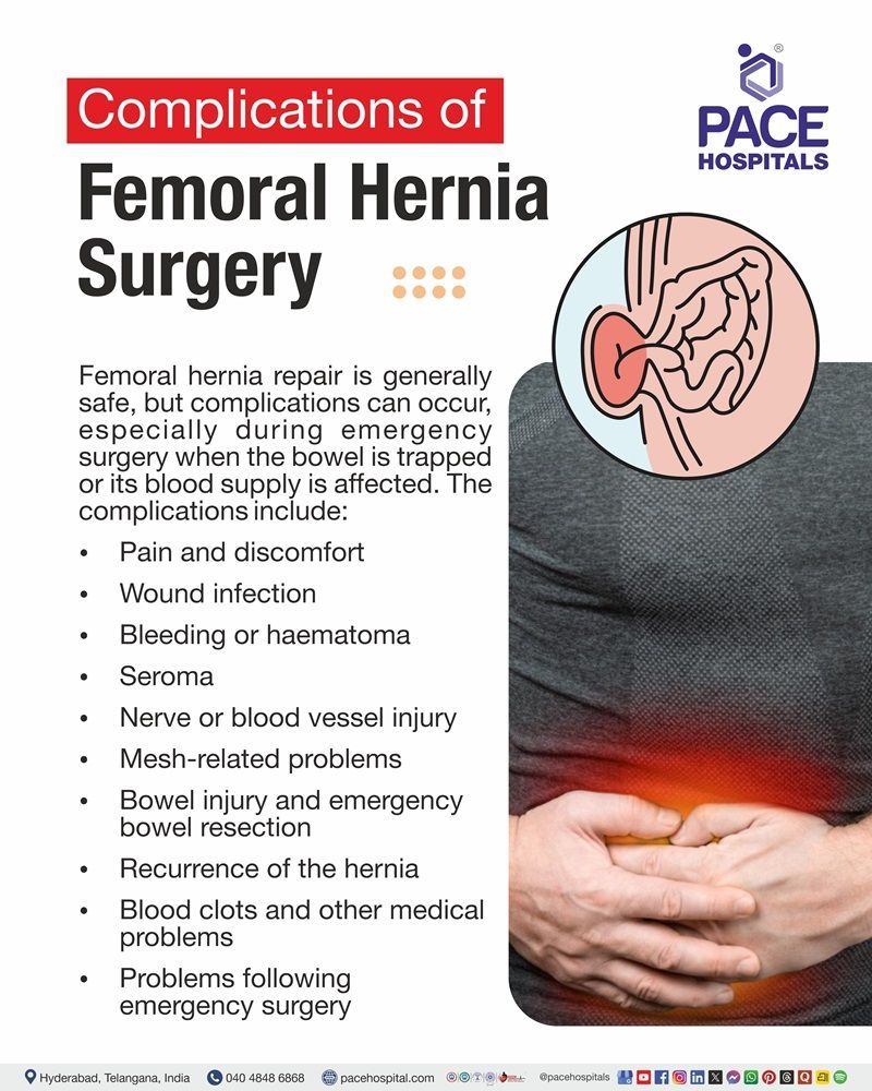Complications of Femoral Hernia Surgery Complications of femoral hernia surgery including pain, infection, bleeding, seroma, bowel injury and hernia recurrence