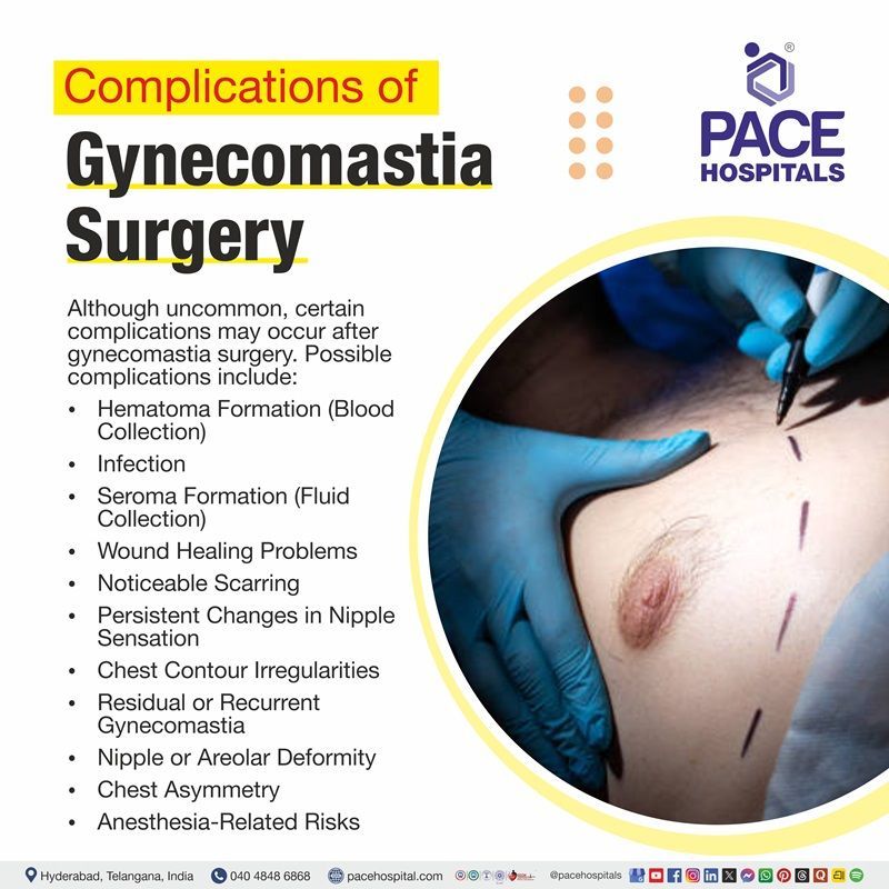 Gynecomastia Surgery Complications illustration depicting the complications and risks assocciated with Gynecomastia surgery
