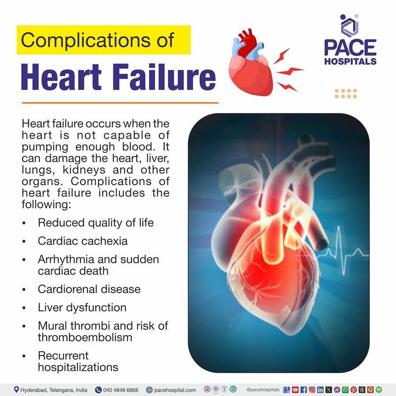 Complications of heart failure Complications of heart failure | image narrating the complications of Heart failure