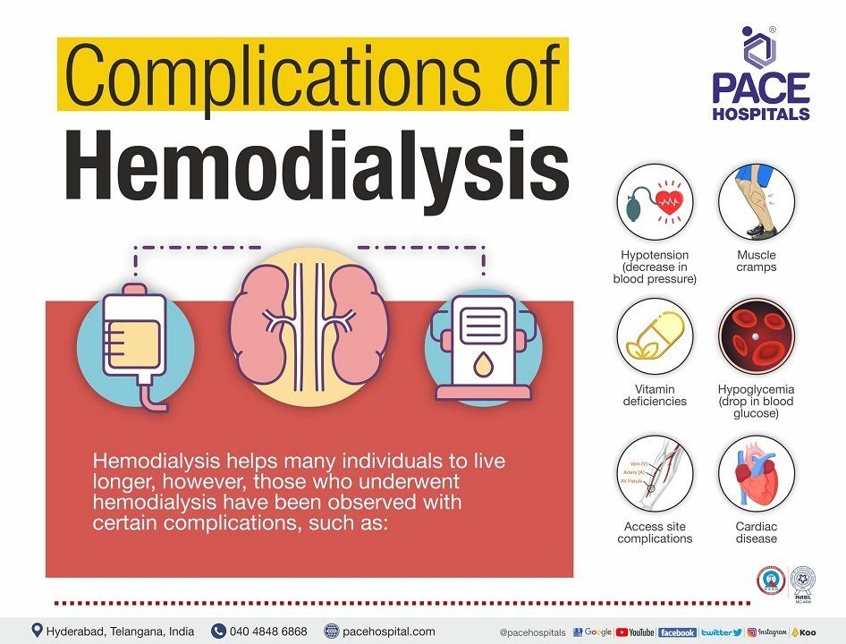 complications in hemodialysis patients | acute complications of hemodialysis hemodialysis complications and management | hemodialysis side effects complications