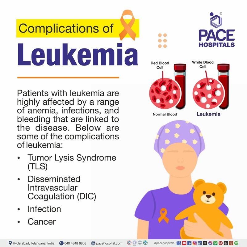 Complications of leukemia leukemia Complications | infographic showing the complications of leukemia