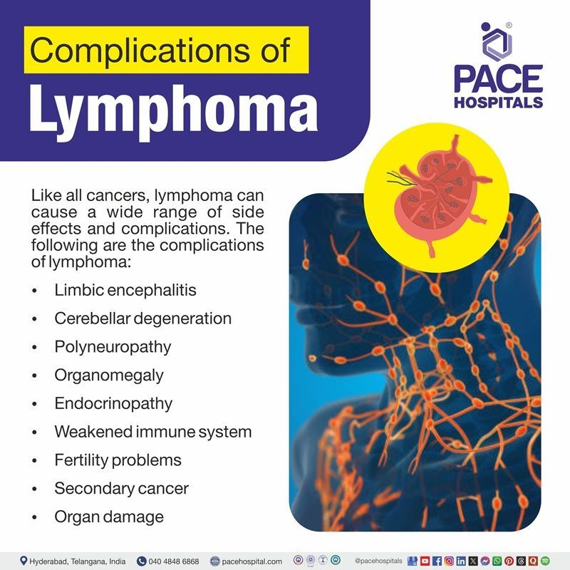 Complications of lymphoma complications of lymphoma | image showing the various complications of hodgkin's lymphoma
