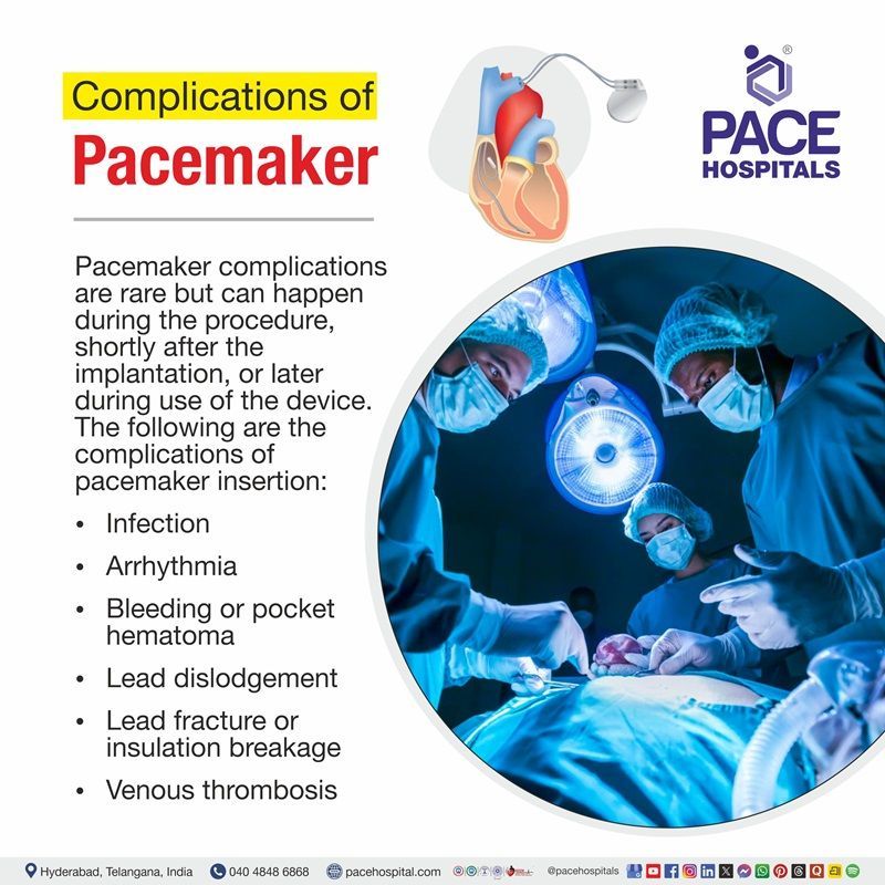 Pacemaker Contraindications Illustration showing the Contraindications of Pacemaker | signs when pacemaker is not required
